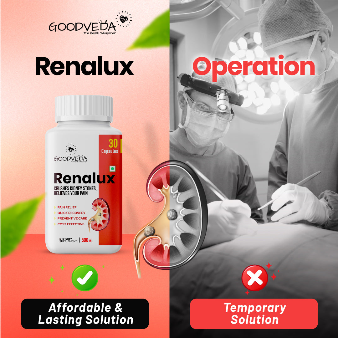 Renalux #1 ayurvedic formula for a stone free life, Naturally Best results in 45 days.