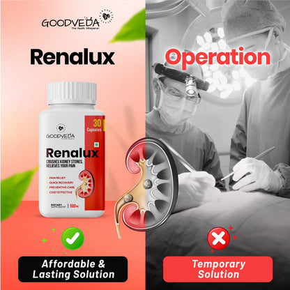 Renalux #1 ayurvedic formula for a stone free life, Naturally Best results in 45 days.